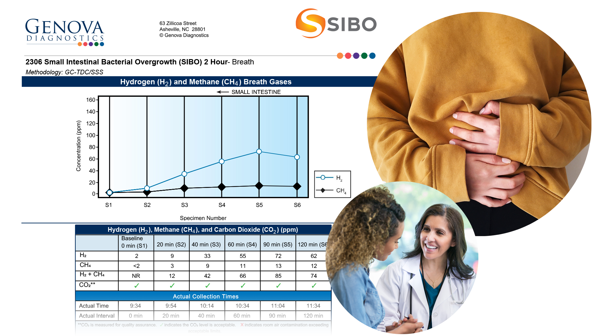 Small Intestinal Bacterial Overgrowth Test